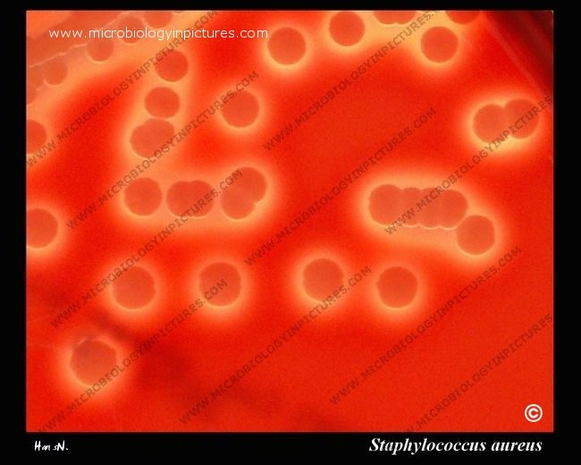 Colonies of Staphylococcus aureus surrounded by betahemolysis..